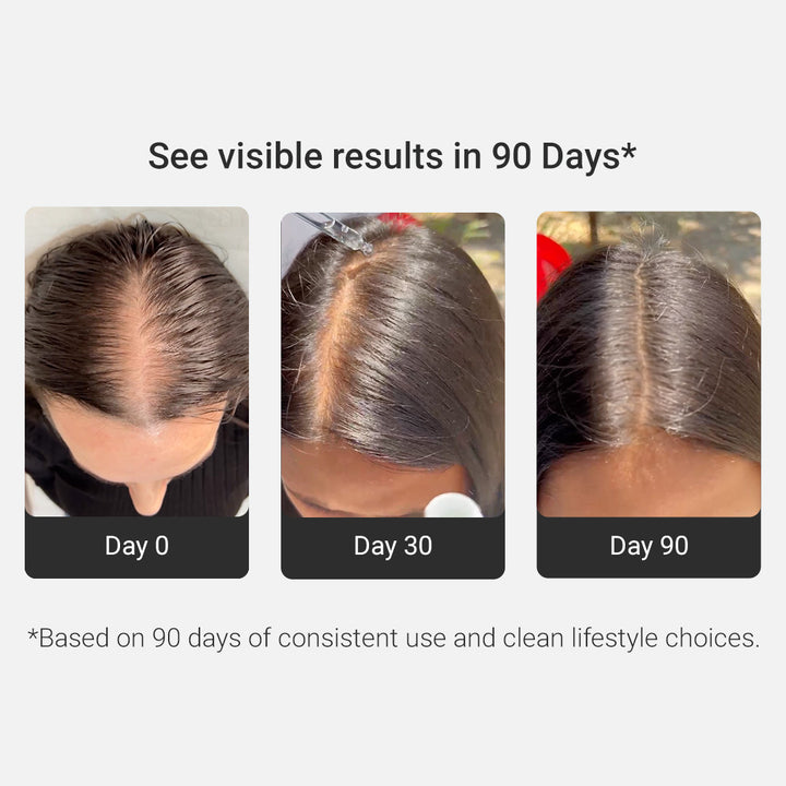 Intensive Hair Growth Serum | Derma Roller (FREE)